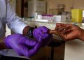 Why CD4 Count Still Matters for People Returning to HIV Treatment