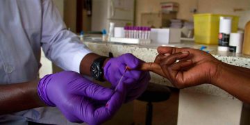 Why CD4 Count Still Matters for People Returning to HIV Treatment
