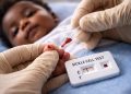 Uganda Intensifies Sickle Cell Screening as 9,000 Children Die Annually