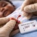 Uganda Intensifies Sickle Cell Screening as 9,000 Children Die Annually